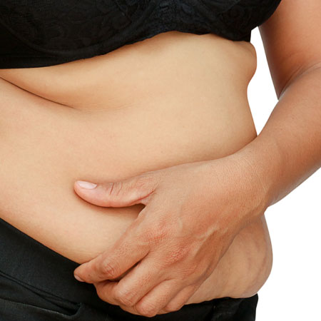 Mommy Makeover treatment in Kanhangad