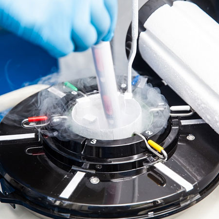 Oocyte and Embryo Cryopreservation in Kanhangad