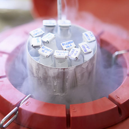 Semen Cryopreservation in Kanhangad